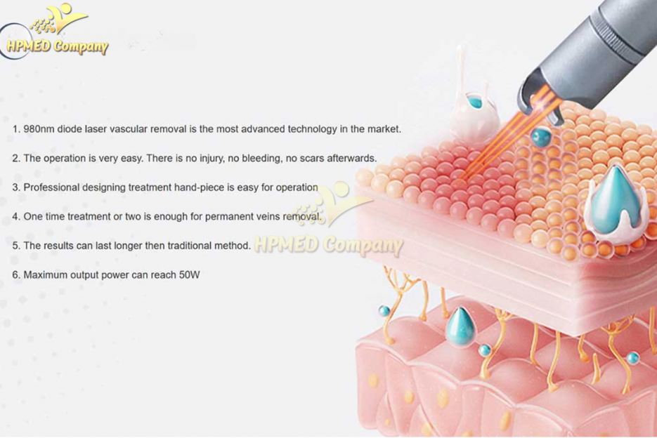 Phân loại các loại Laser ND:YAG hiện nay 2 Laser ND:YAG Long Pulse (Xung dài)