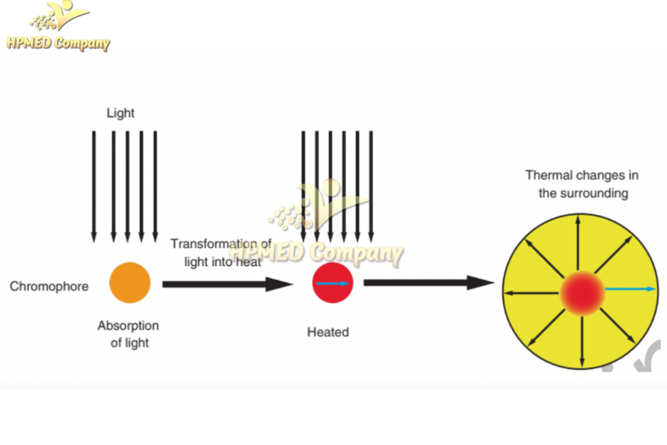 Máy giảm béo LS650: Có nên đầu tư hay không?