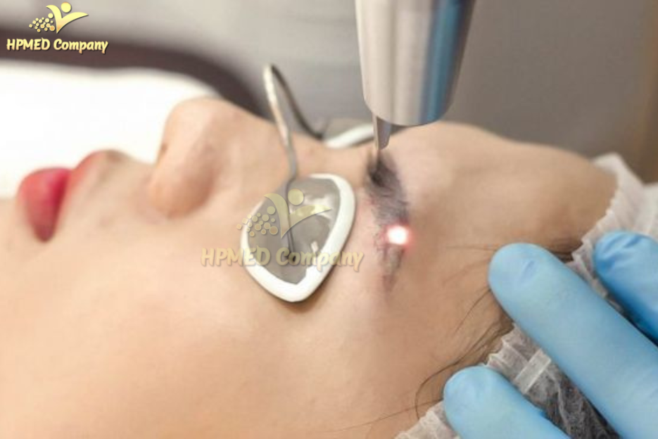 Máy Laser Xoá Xăm