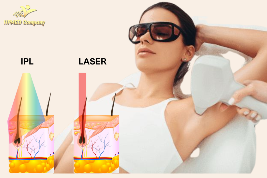 Cơ chế tác động của công nghệ triệt lông vĩnh viễn