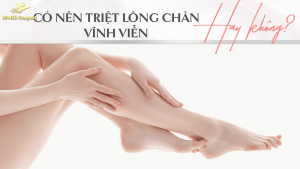 triệt lông chân có các phương pháp gì ? chi phí triệt lông chân ?