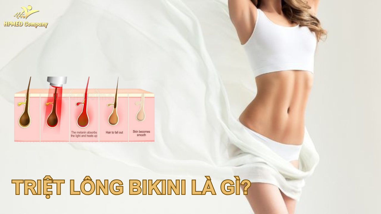 Giới thiệu về triệt lông bikini