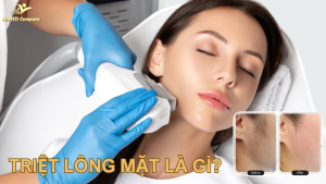 triệt lông mặt là gì ? có những phương pháp gì ? chi phí bao nhiêu ?
