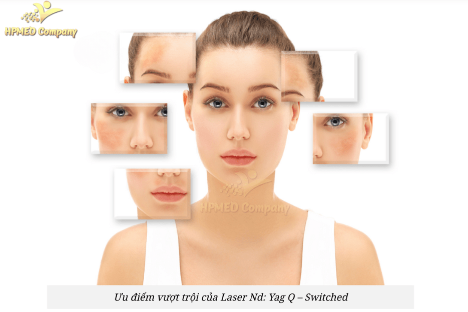 Kết Quả Điều Trị Bằng Laser ND YAG Q-Switched