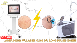 So sánh Laser 980nm và Laser Xung Dài Long Pulse 1064nm
