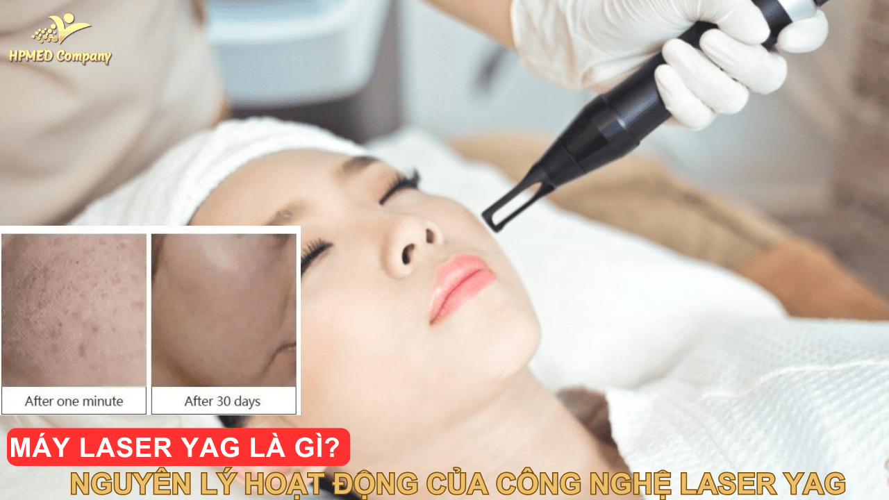 Máy Laser YAG Là Gì? Nguyên Lý Hoạt Động Của Công Nghệ Laser YAG 2025