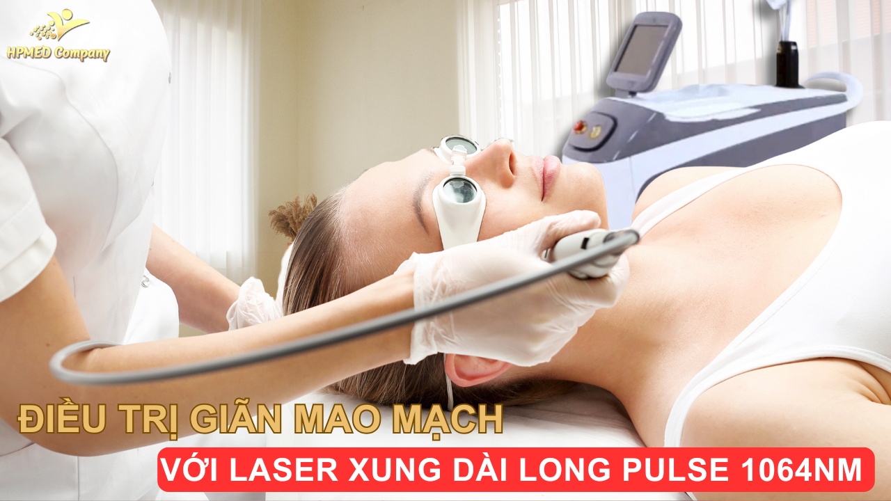 Giới Thiệu Công Nghệ Điều Trị Giãn Mao Mạch Laser Xung Dài Long Pulse 1064nm
