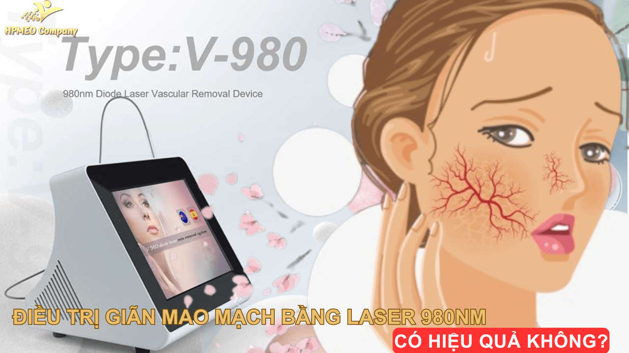 Điều Trị Giãn Mao Mạch Bằng Laser 980nm Có Hiệu Quả Không? 1 Điều Trị Giãn Mao Mạch Bằng Laser 980nm Có Hiệu Quả Không?