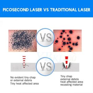 Nanosecond và Picosecond – Sự Khác Biệt và Ứng Dụng Trong Thẩm Mỹ