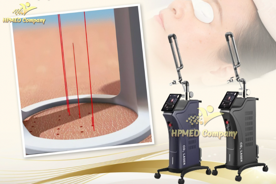 Công nghệ Laser co2 fractional