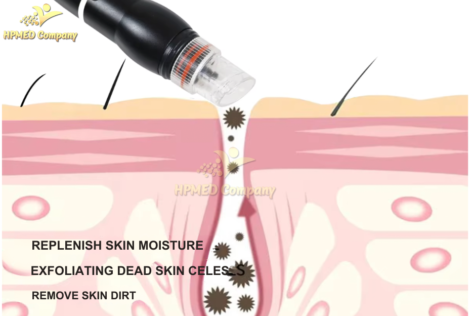 Máy Oxy Jet làm sạch sâu