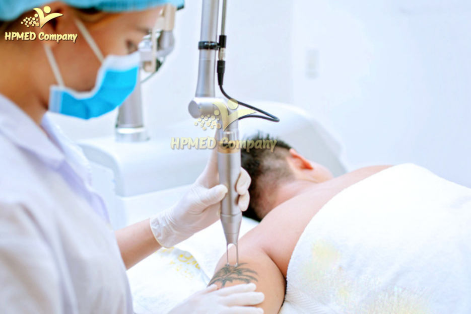 Quy trình xóa xăm bằng máy xoá xăm laser