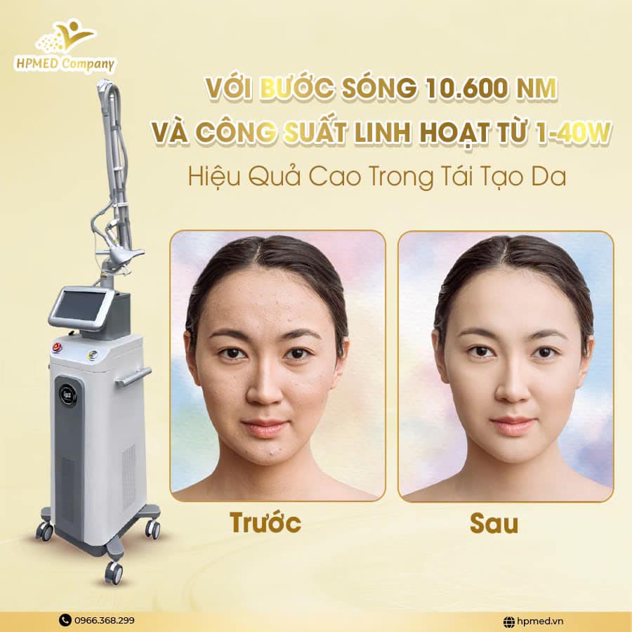 Máy Laser CO2 Fractional PrismXel Hàn Quốc
