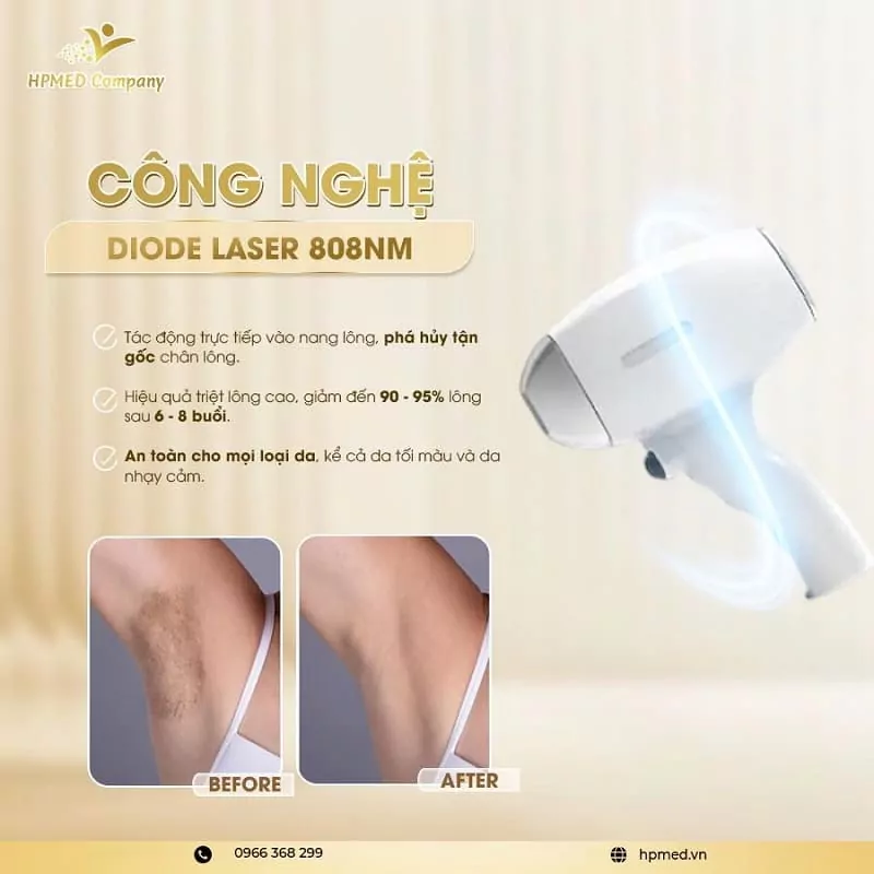 Máy Triệt Lông Diode Laser Cao Cấp