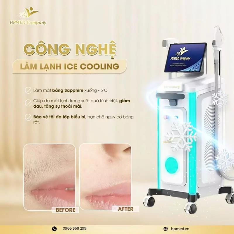Máy Triệt Lông Diode Laser Cao Cấp