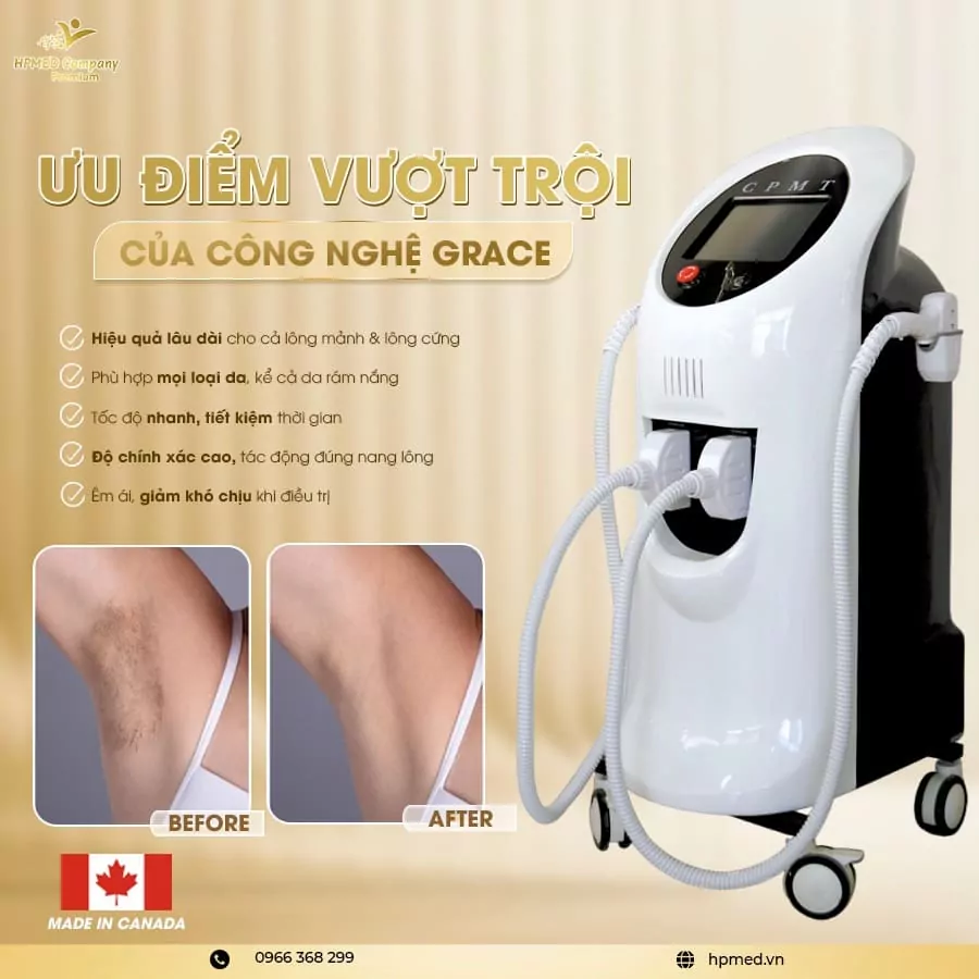 Máy Triệt Lông Diode Laser Cao Cấp