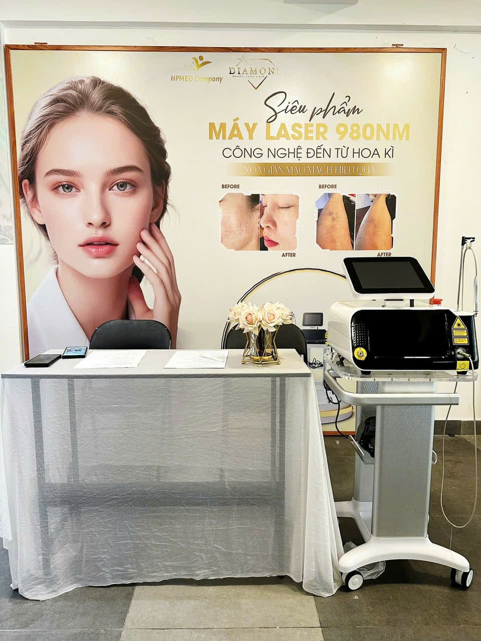 Máu Diode Laser 980nm Điều Trị Giãn Mao Mạch