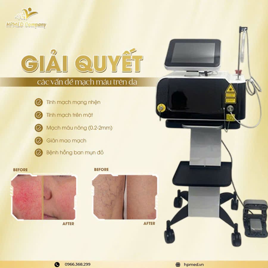 máy điều trị giãn mao mạch diode laser 980nm