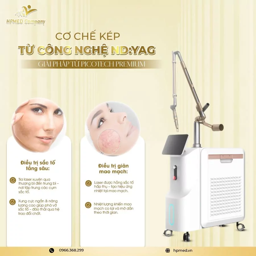 Máy Laser Pico Tech Premium - Sanhe - Bắc Kinh