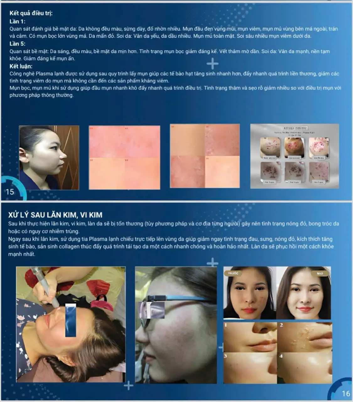 máy plasma lạnh plasma rosy - 18