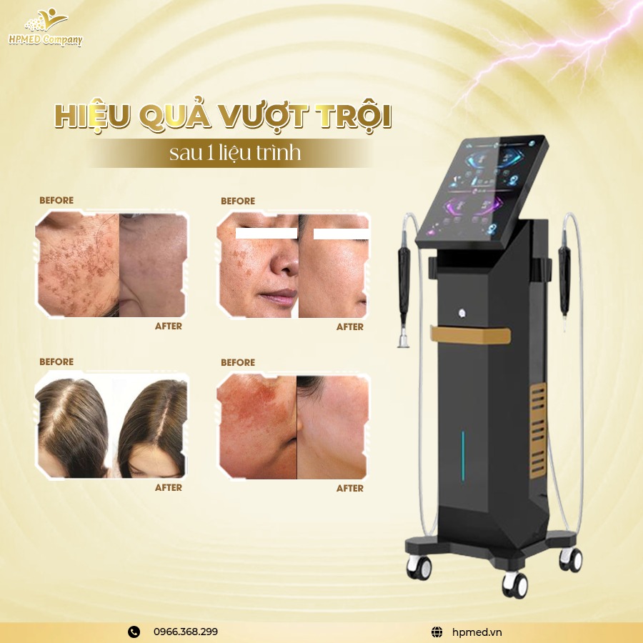 Máy Plasma Fusion Faceage