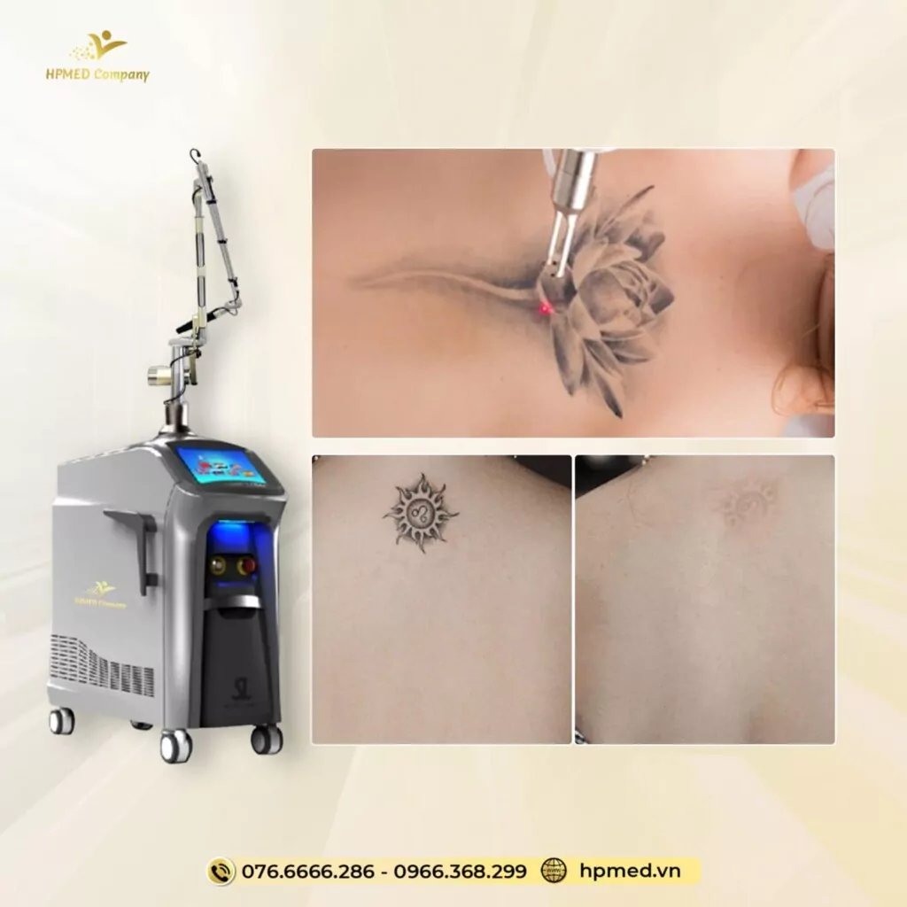 Máy Laser ND YAG Q-Switch SL-NY 602 | Bắc Kinh