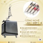 Máy Laser ND YAG QSwitch QMAX Hàn Quốc 💎 Công Nghệ Laser Thẩm Mỹ Hiện Đại 2025