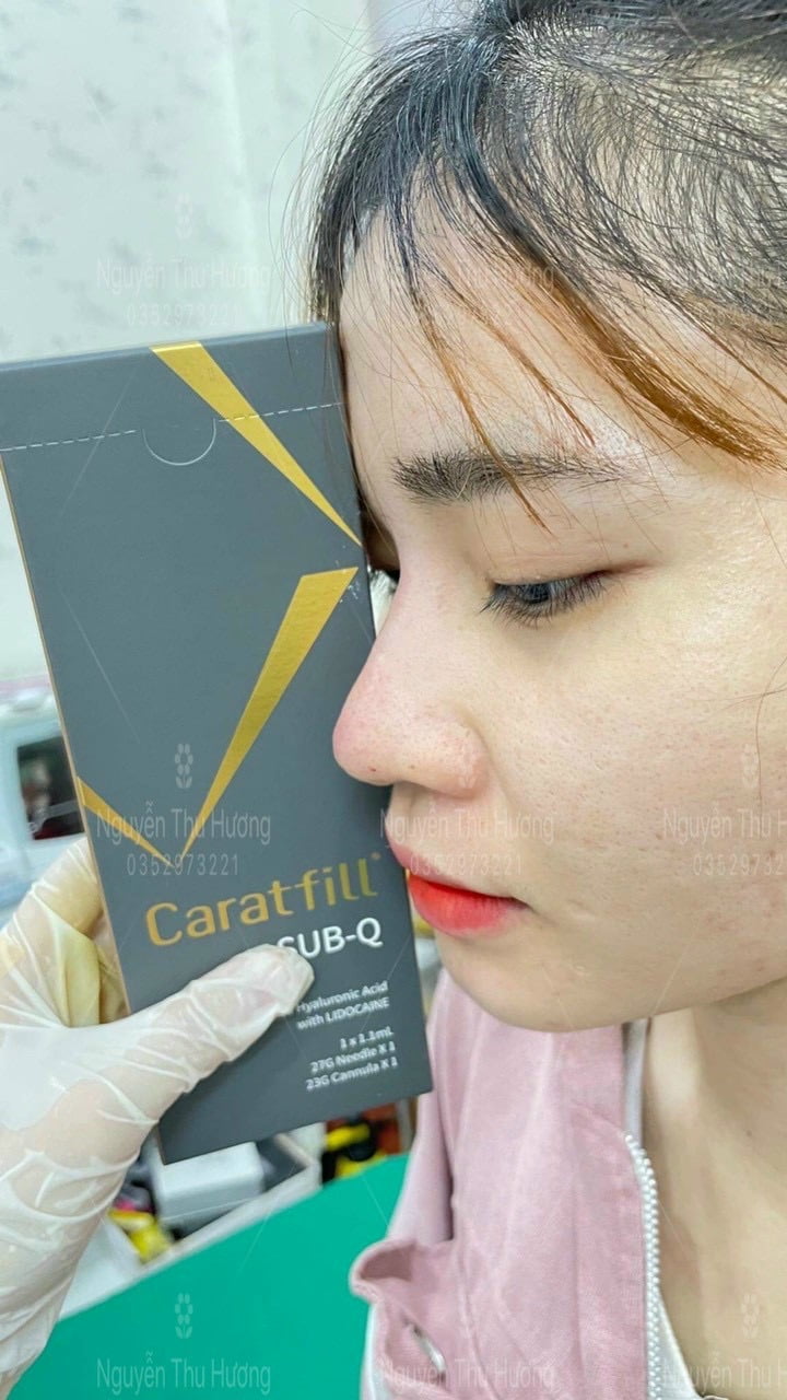 Sản Phẩm Tiêm Filler Caratfill Hàn Quốc