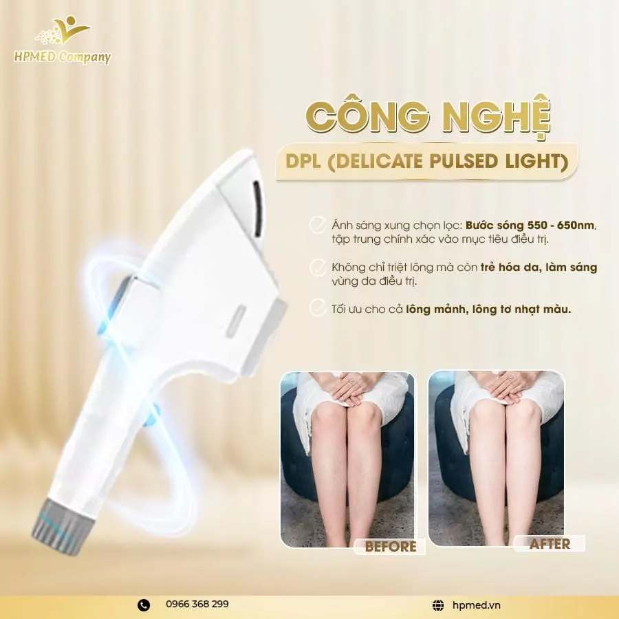 Tay cầm thiết bị HPLUXURY