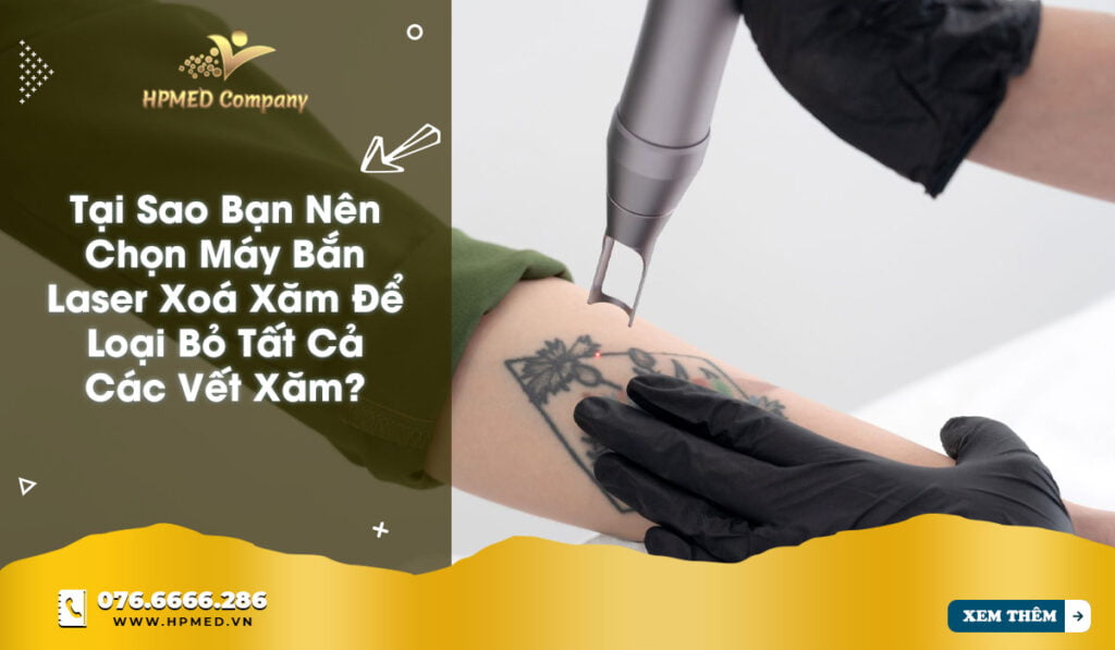 tại sao nên chọn máy bắn laser để xoá xăm