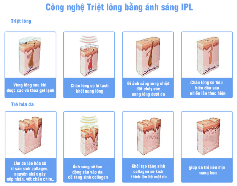 cach su dung may triet long ipl 1 e1666662038342