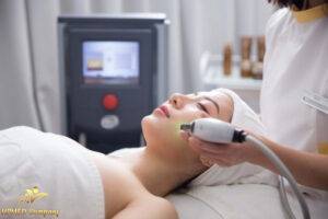 Máy triệt lông Spa