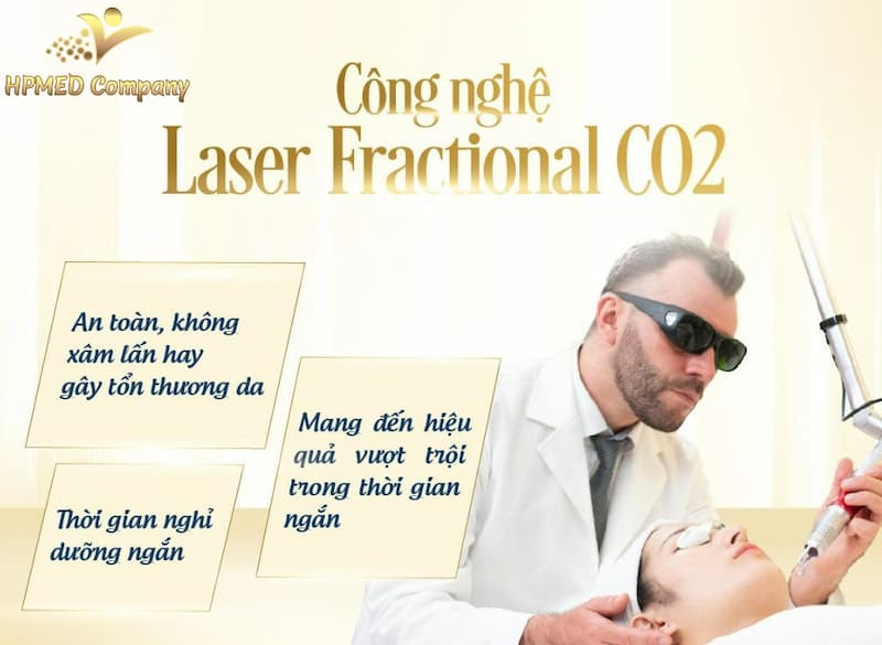 máy laser co2 giá bao nhiêu