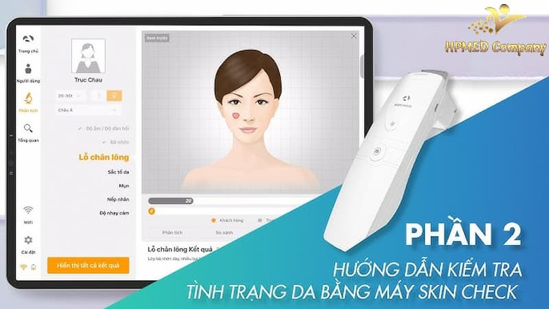 phần mềm máy soi da