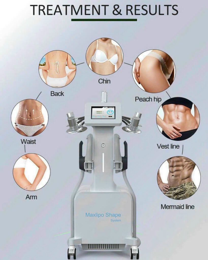 MÁY GIẢM BÉO MAXLIPO SHAPE - 02