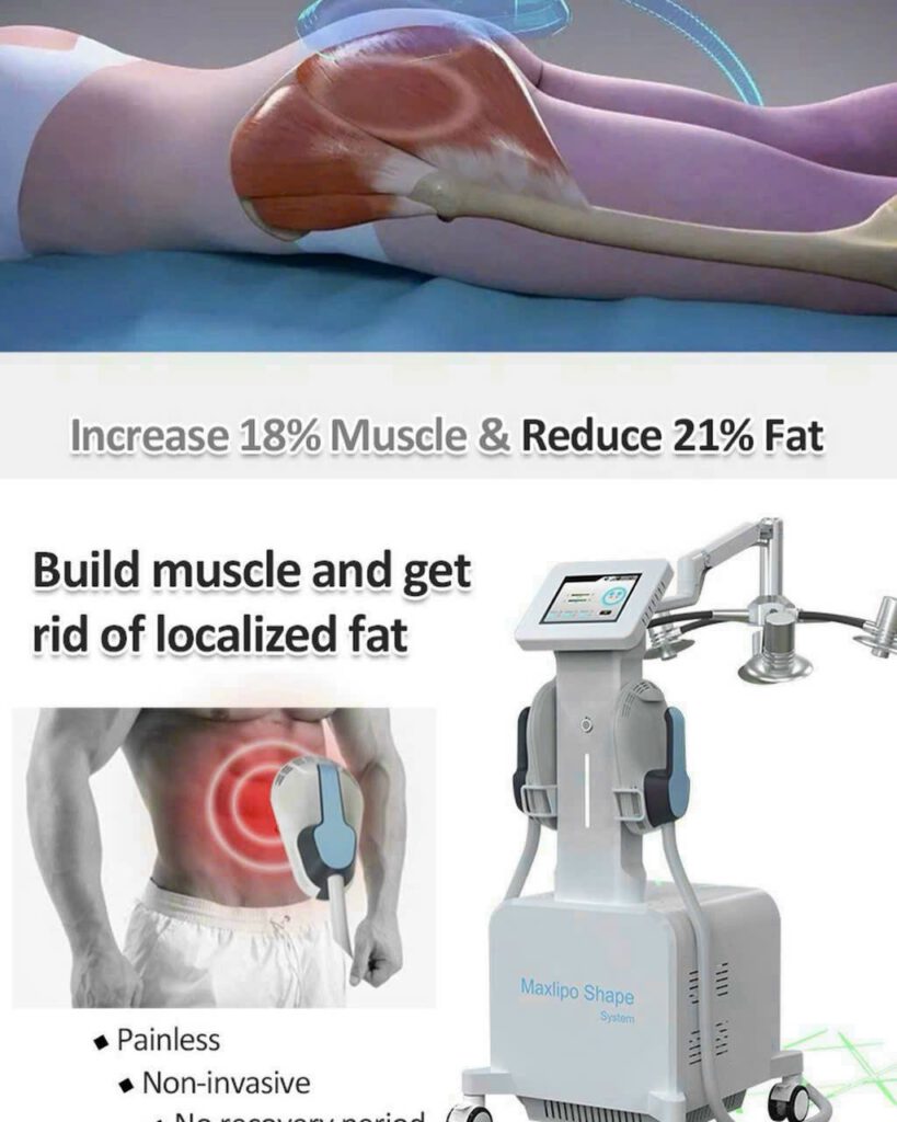 MÁY GIẢM BÉO MAXLIPO SHAPE - 13