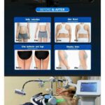 MÁY GIẢM BÉO MAXLIPO SHAPE - 16