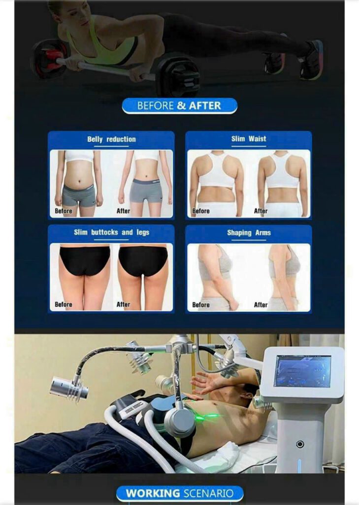 MÁY GIẢM BÉO MAXLIPO SHAPE - 16