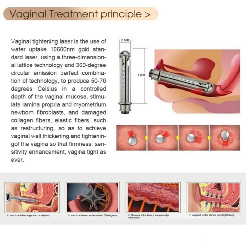 MÁY LASER CO2 FRACTIONAL TAIBO - 008