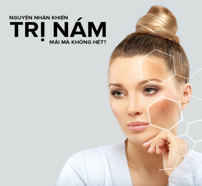 Phác đồ điều trị nám an toàn