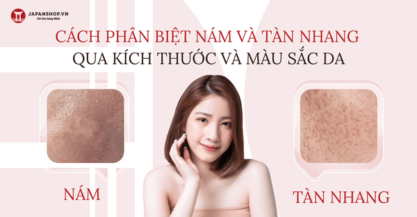 Sự Khác Biệt Giữa Nám và Tàn Nhang