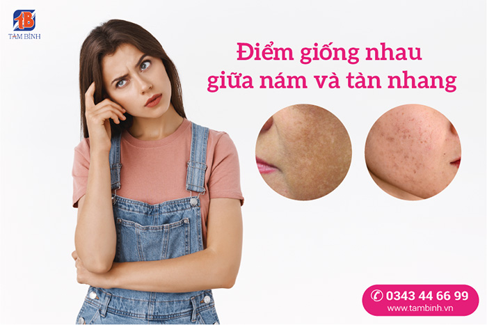 Sự Khác Biệt Giữa Nám và Tàn Nhang