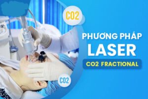 Laser CO2 Fractional là gì? Ưu điểm và ứng dụng của Laser Fractional CO2