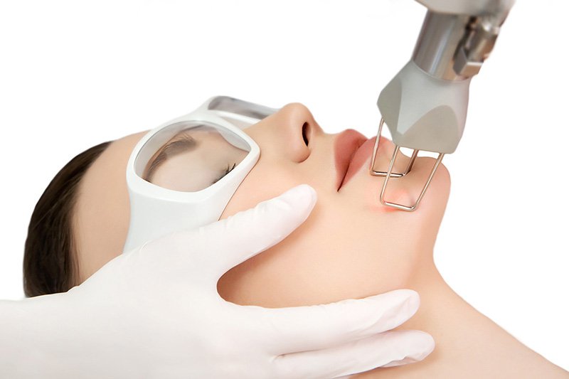 Hình 4: Phương pháp Fractional CO2 Laser có xảy ra 1 số tác dụng phụ