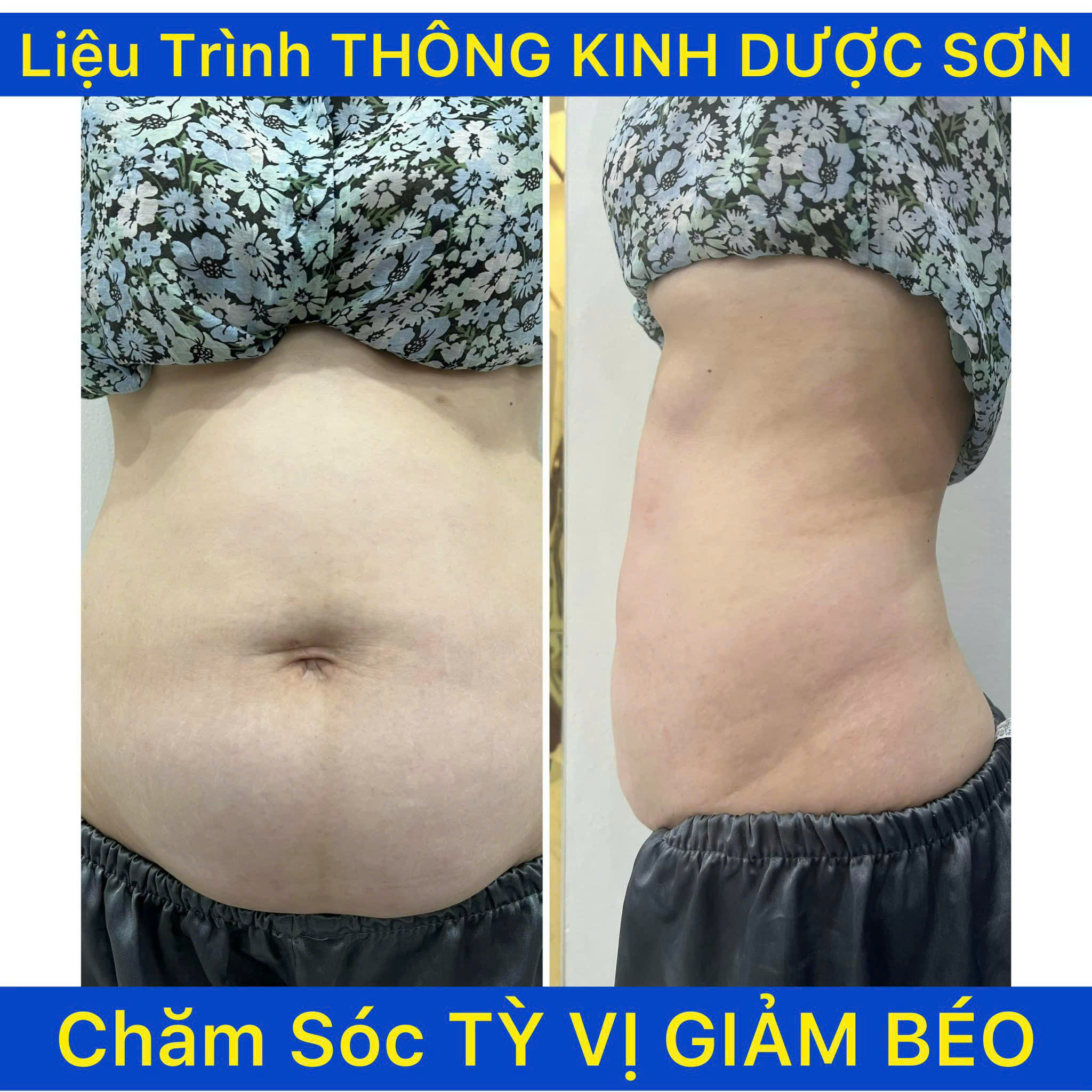 Máy Điện Sinh Học DDS - 04