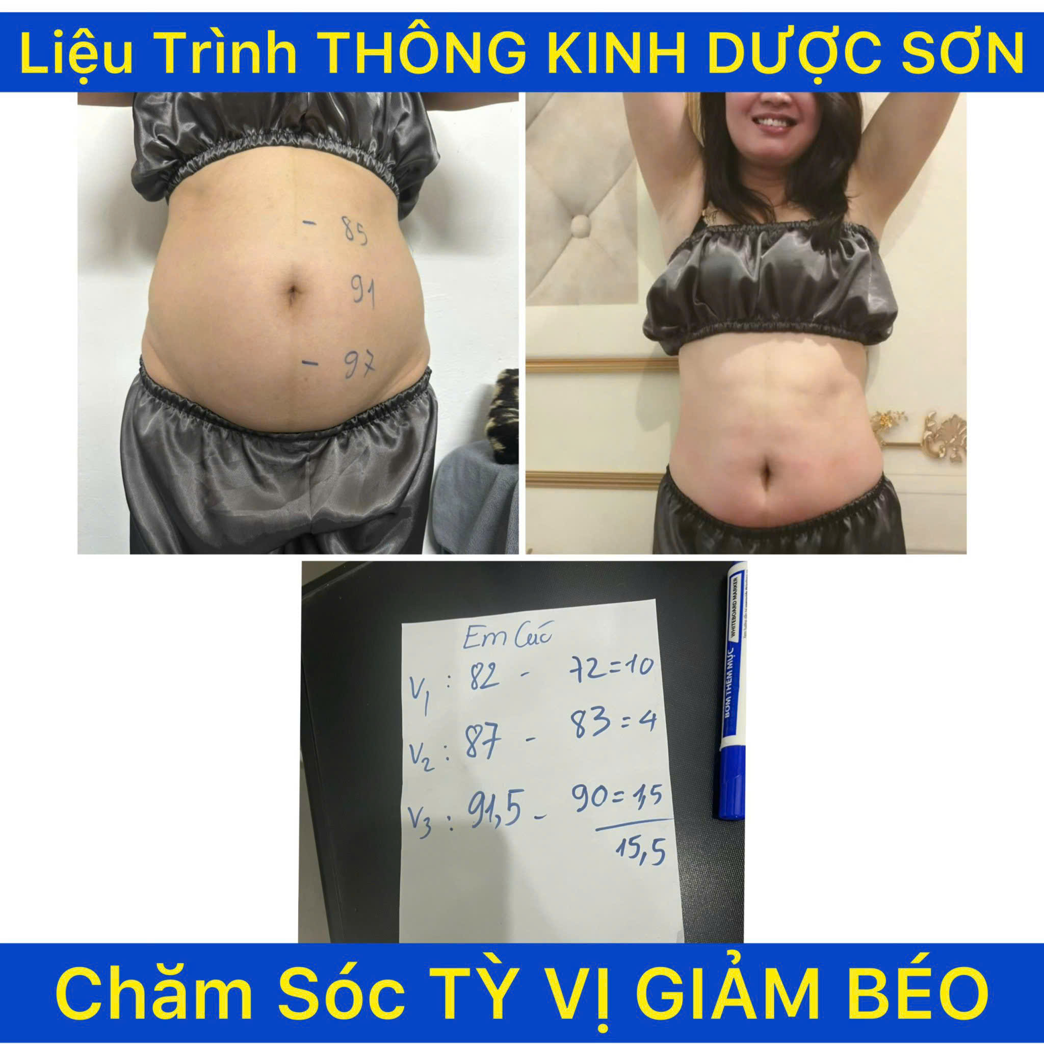 Máy Điện Sinh Học DDS - 05