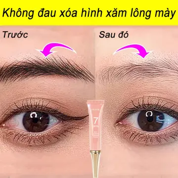 Cách Xóa Xăm Lông Mày Hiệu Quả Hướng Dẫn Chi Tiết An Toàn