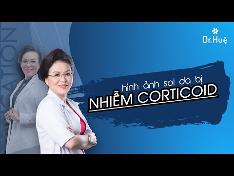 Hình ảnh soi da bị nhiễm corticoid