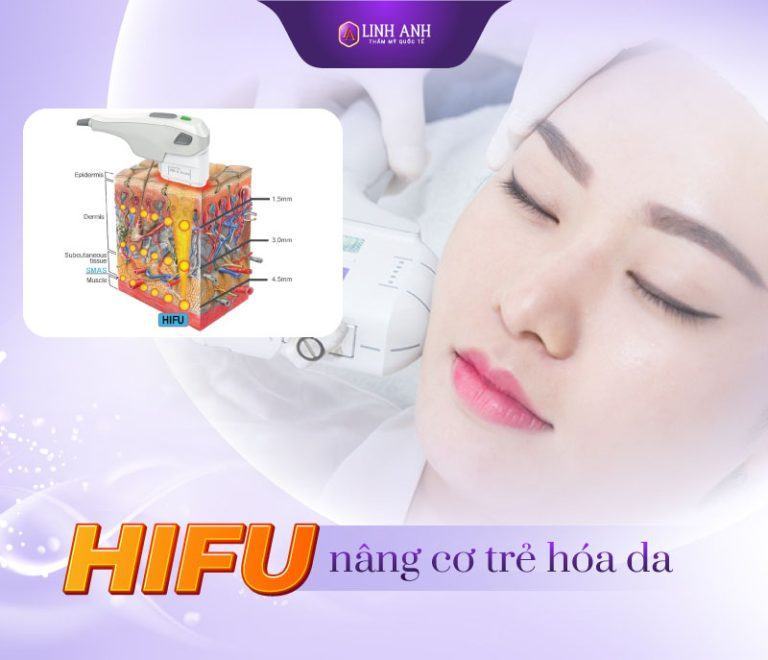 Máy HIFU là gì? Khám phá công nghệ làm đẹp tiên tiến