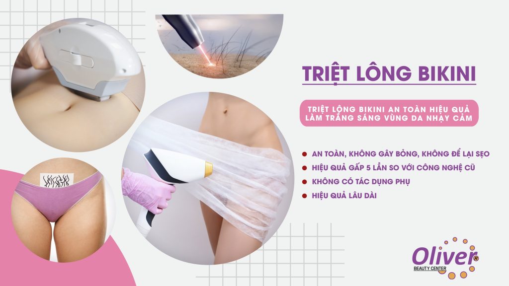 Máy Triệt Lông Bikini Tốt Nhất Hiện Nay